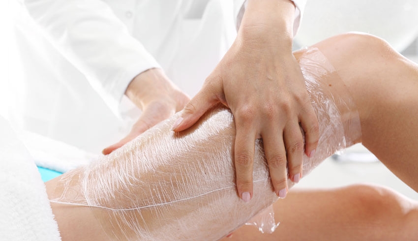Cellulite Treatment