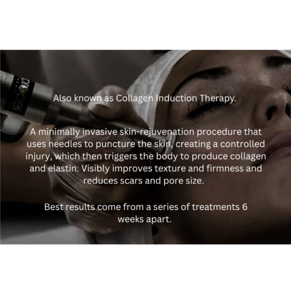 Procell Microchanneling at Assure Esthetics by Alisha in York, NE