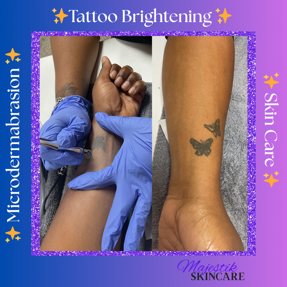 Tattoo Brightening at Majestik Skincare in Mobile, AL