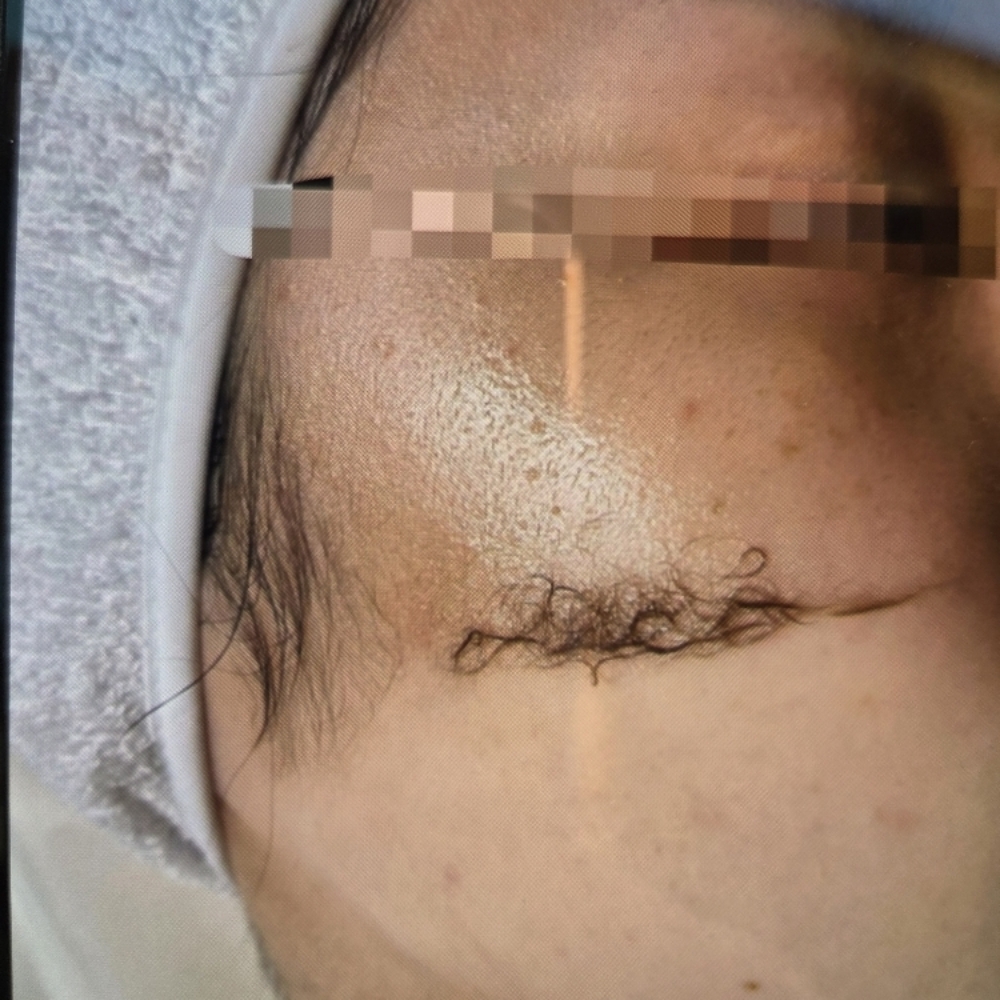 Dermaplaning add-on at Sun Skincare LLC in Scottsdale, AZ