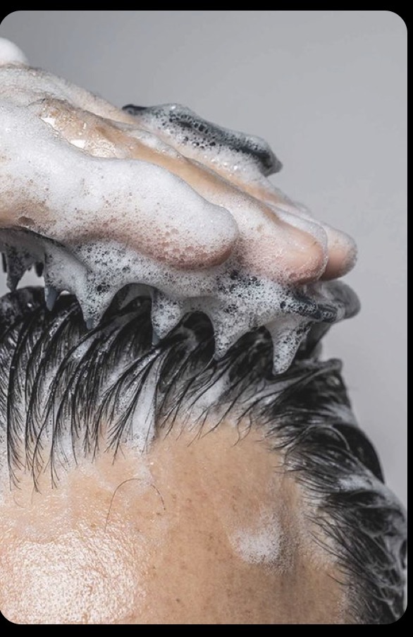 Scalp Treatment