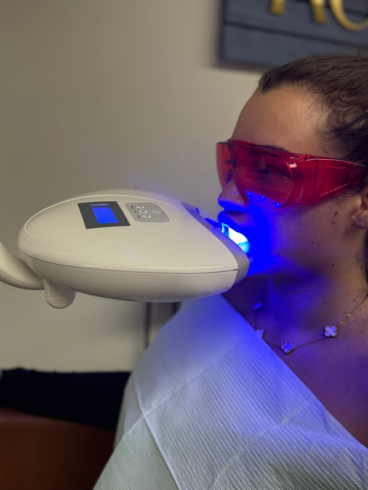Teeth Whitening ADD ON at RainbeautybyHeather in BEAVERCREEK, OH