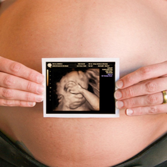 3D4D Ultrasound at Rancho Cucamonga 3D 4D Ultrasound by 4D Special Delivery in Rancho Cucamonga, CA