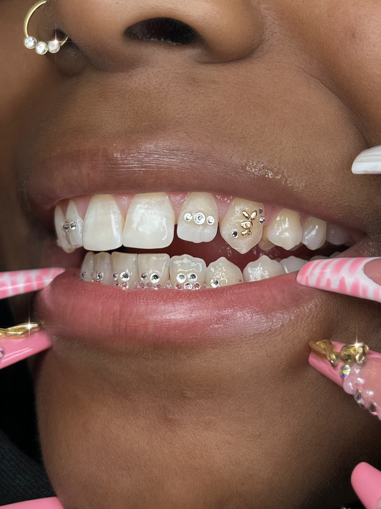 Tooth Gem Curation