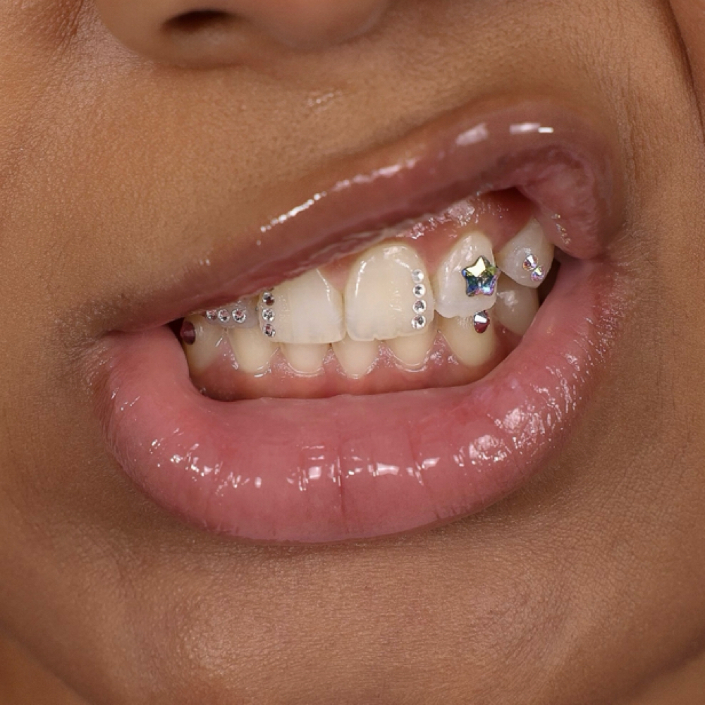 Custom Tooth Gem Set at Celestial Gemz in Hammond, IN