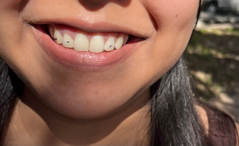 Tooth Gems at A.Rose Beauty in San Antonio, TX