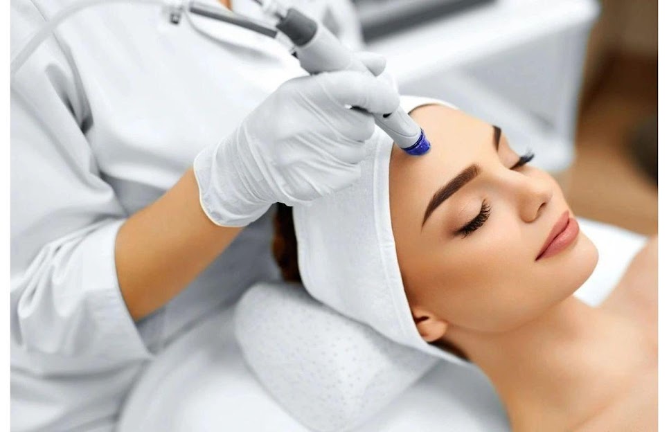 Microneedling with PRF