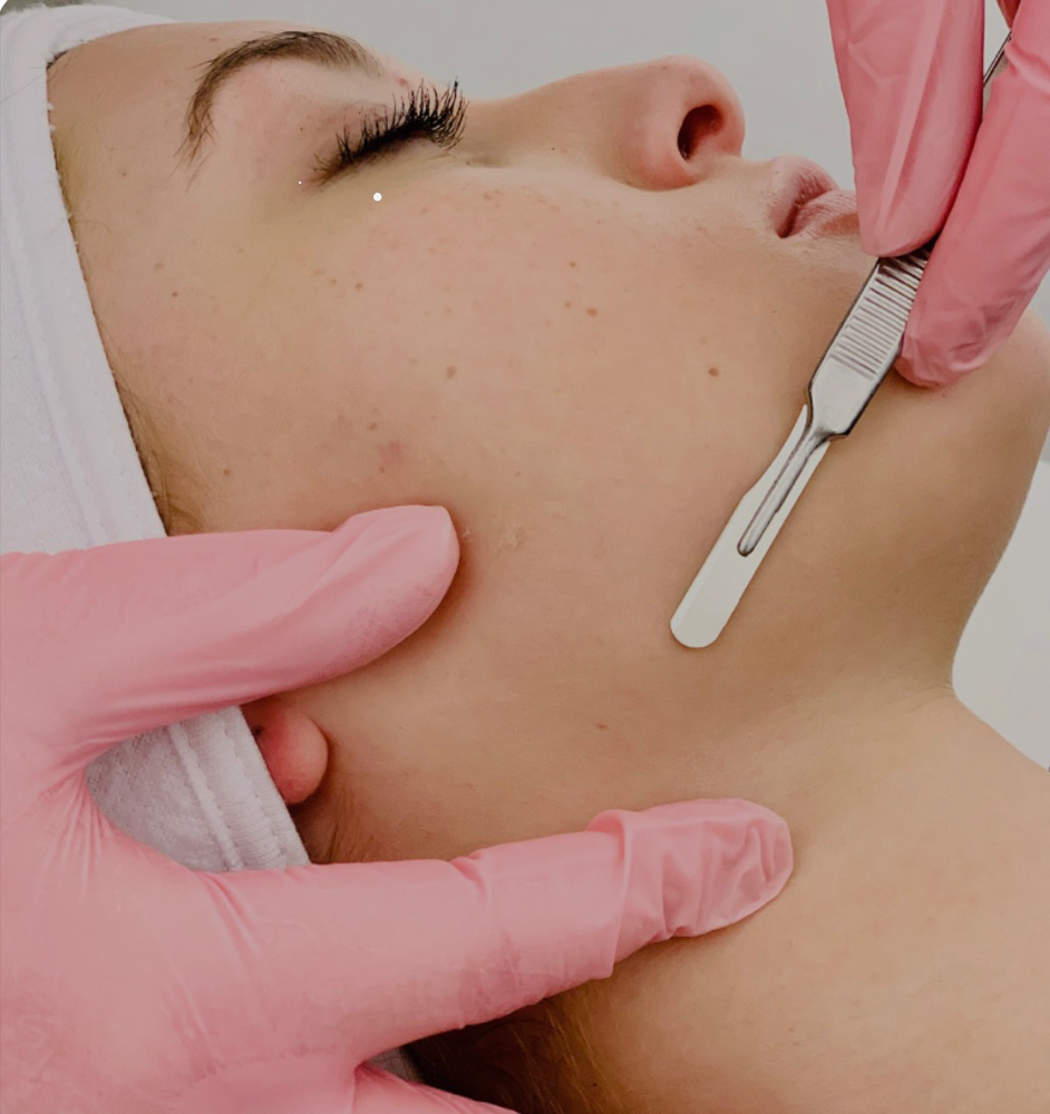 Dermaplane Facial