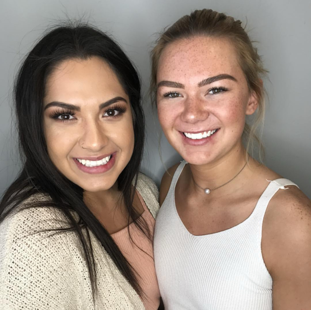 2 People Laser teeth Whitening