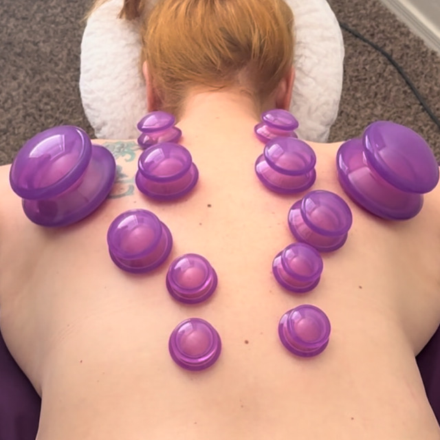 Mobile Add On Cupping Therapy