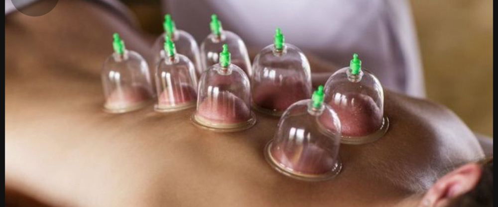 Mobile Cupping Therapy
