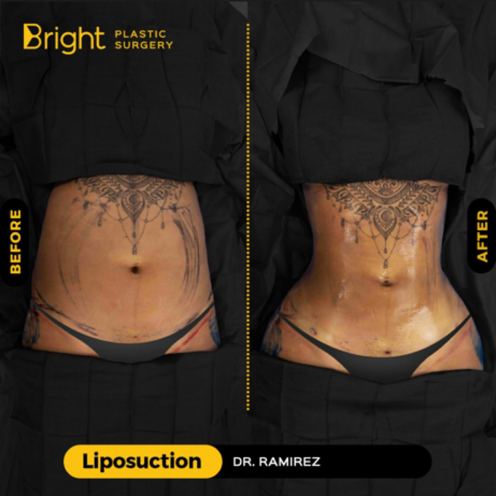 10x90 Post-Op Package at The Neurotherapeutics Massage and Bodywork  LLC in Goldsboro, NC