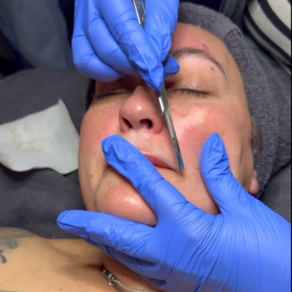 Dermaplaning Facial at Sage Skin & Aesthetics in Kennewick, WA