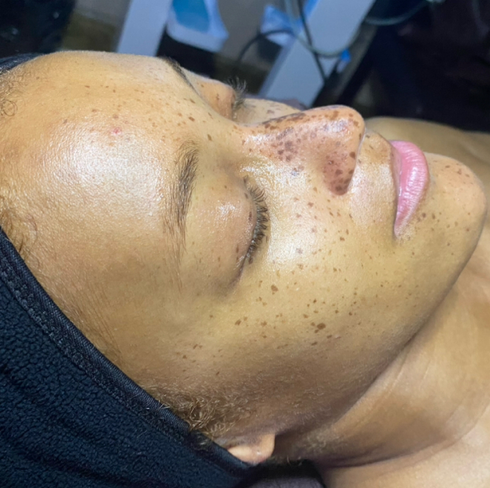 90 min Custom Tranquil Facial at Tranquil Beauty and Wellness Esthetics in Orlando, FL