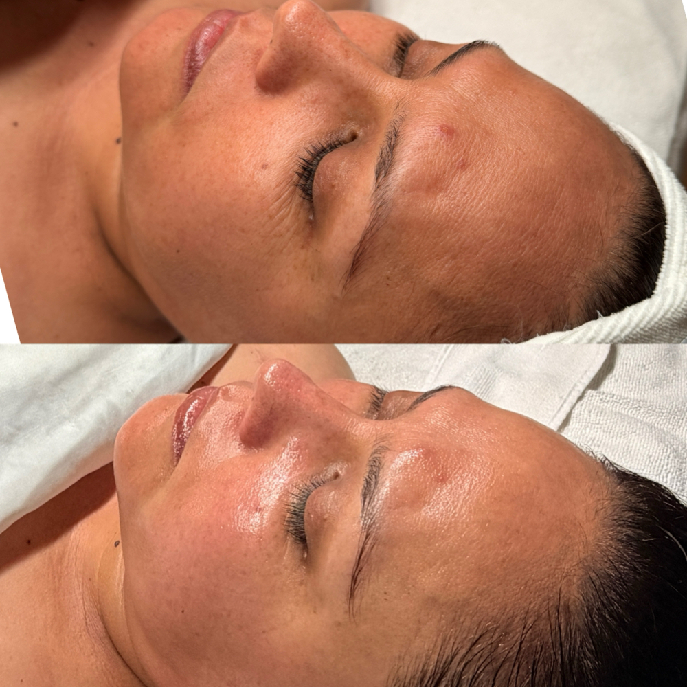 Rejuvenation Facial at Blu Topaz Esthetics in Aurora, IL