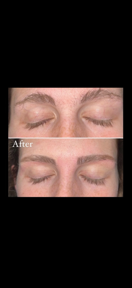 Facial Waxing