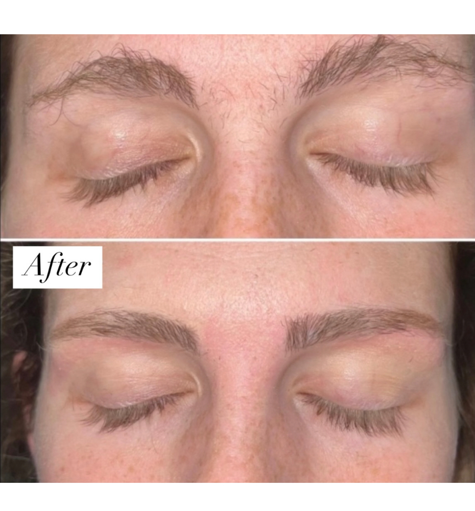 Facial Waxing