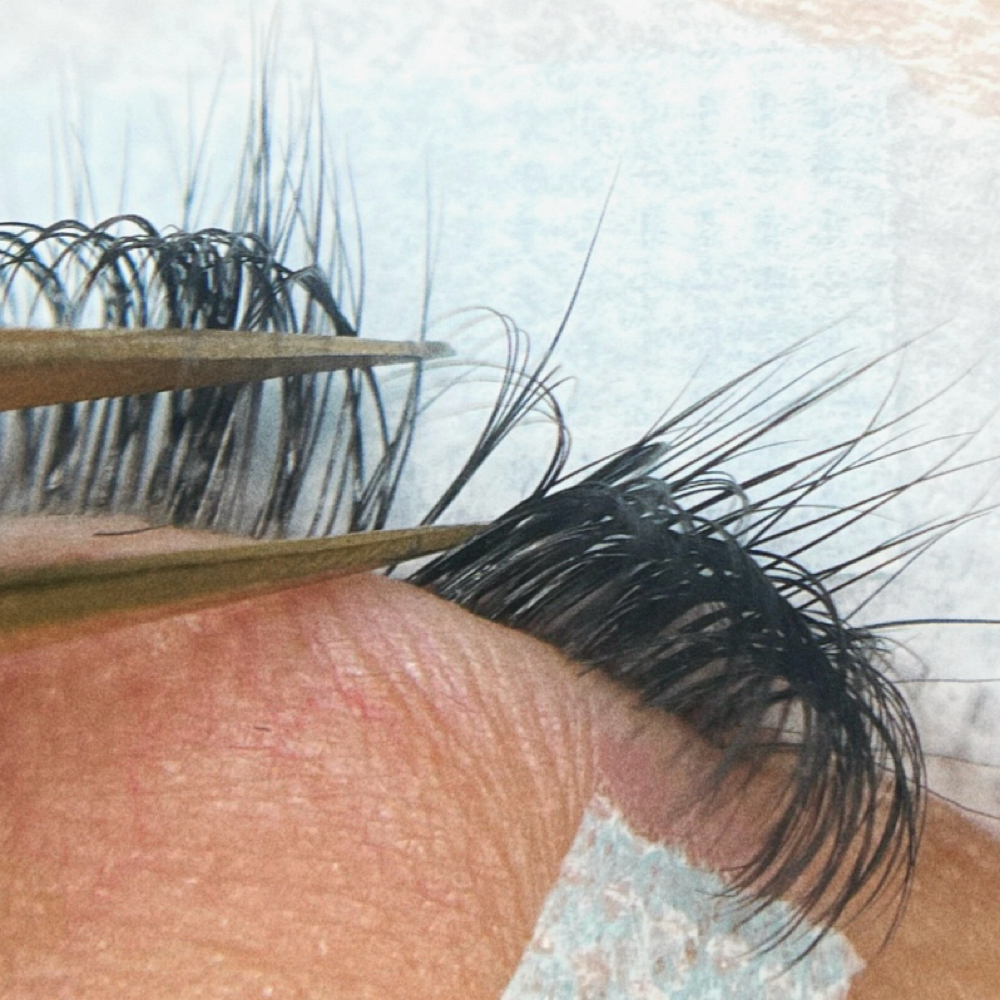 Volume Fill at Little Beauty Clinic in Bonita, CA