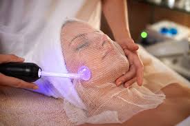 High Frequency Spot Treatment at The Glow Room, LLC in Lawrenceburg, KY
