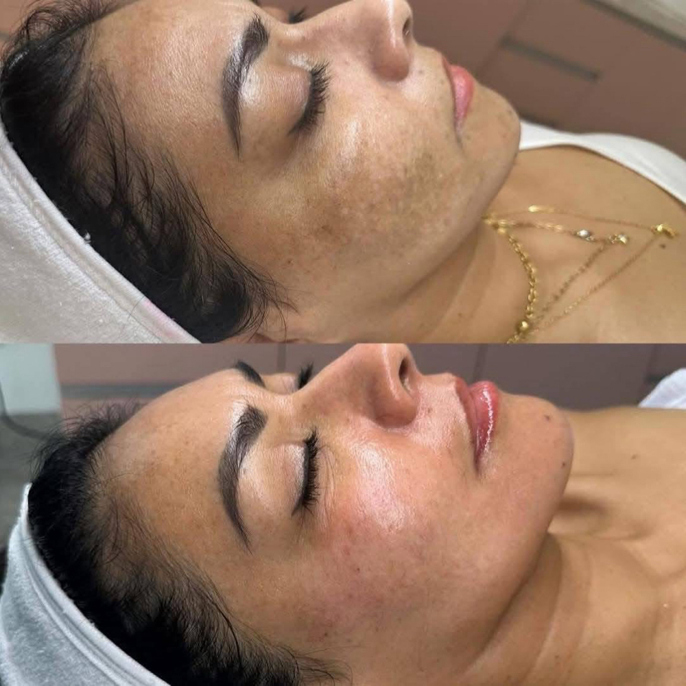 FACIAL at Bella Esthetic and Spa  LLC in Cleveland, OH