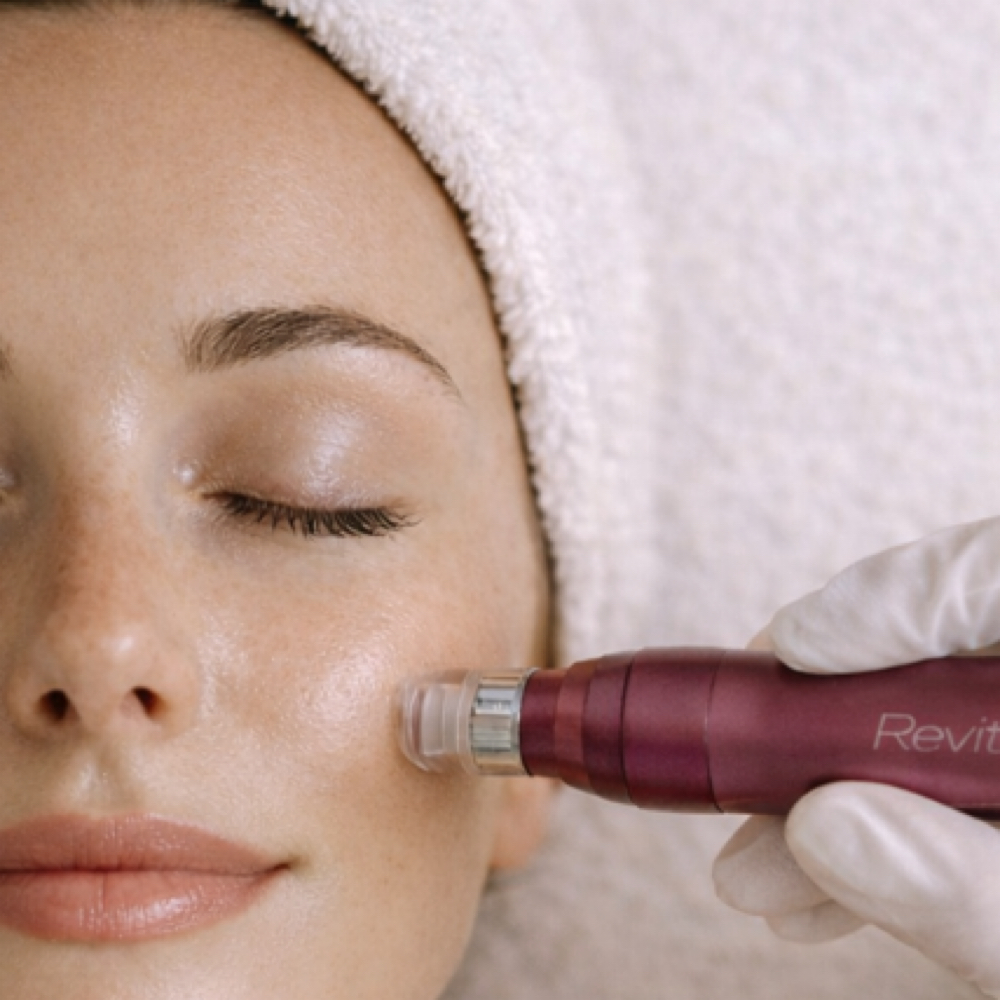 Micro Infusion Add-On