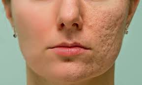 Scar+Pore+texture