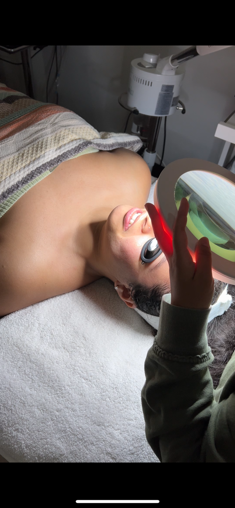 Acne Consultation+Treatment