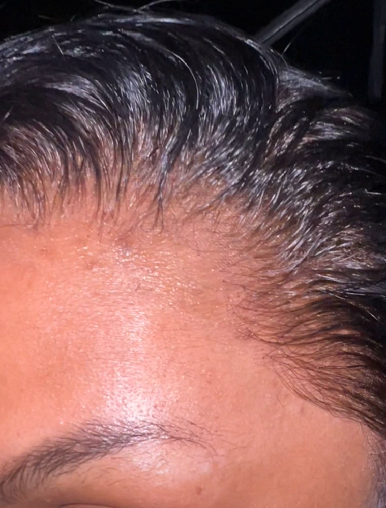Frontal Wig Install
