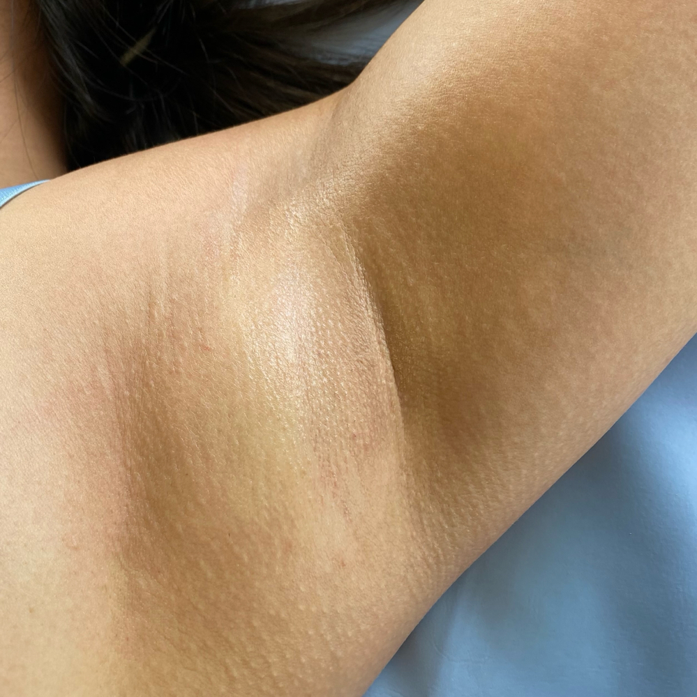 Underarm Wax