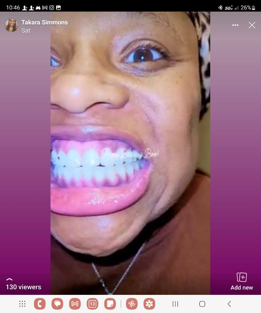 1 Hour Whitening