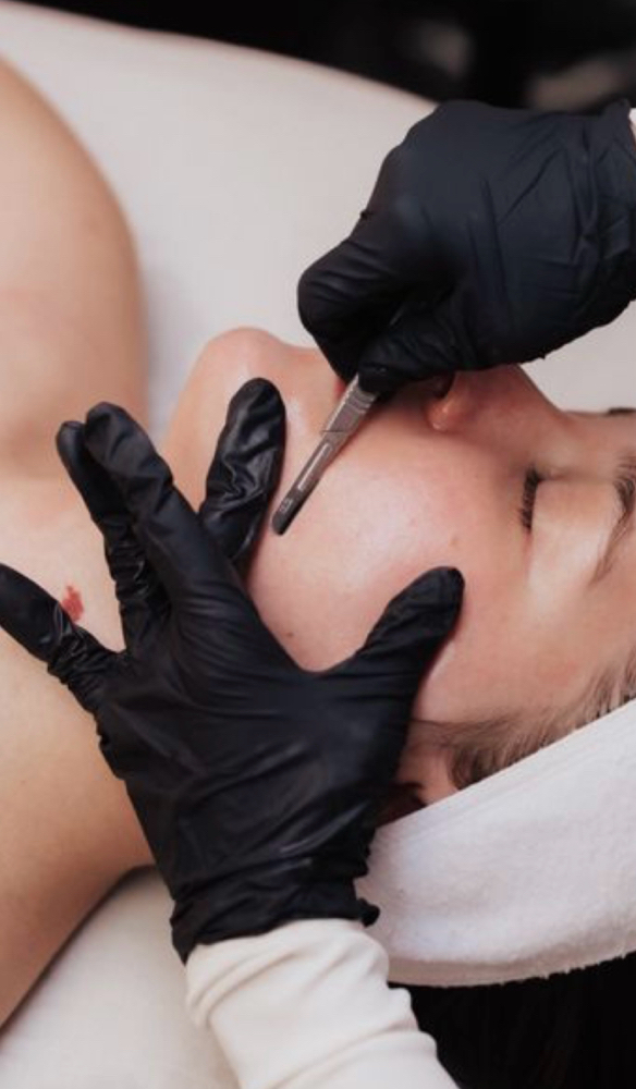 Dermaplaning Facial