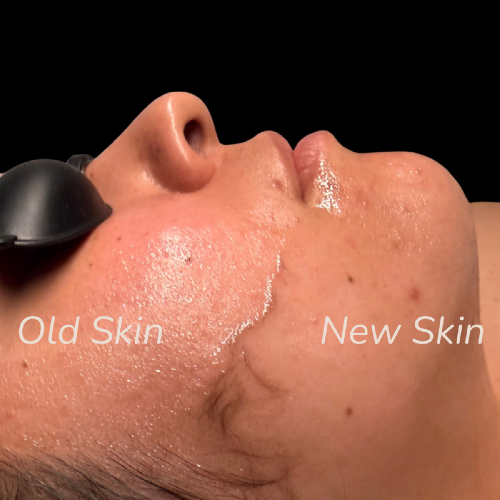 The Dermaplane Deluxe at Desert Belle Esthetics in Albuquerque, NM