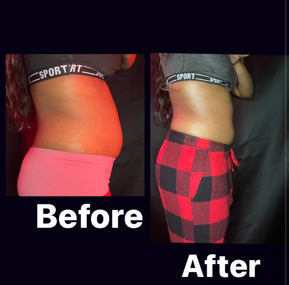 WaistLine Snatched 360 (3 Sessions) at Royal Glow Experience LLC in Houston, TX