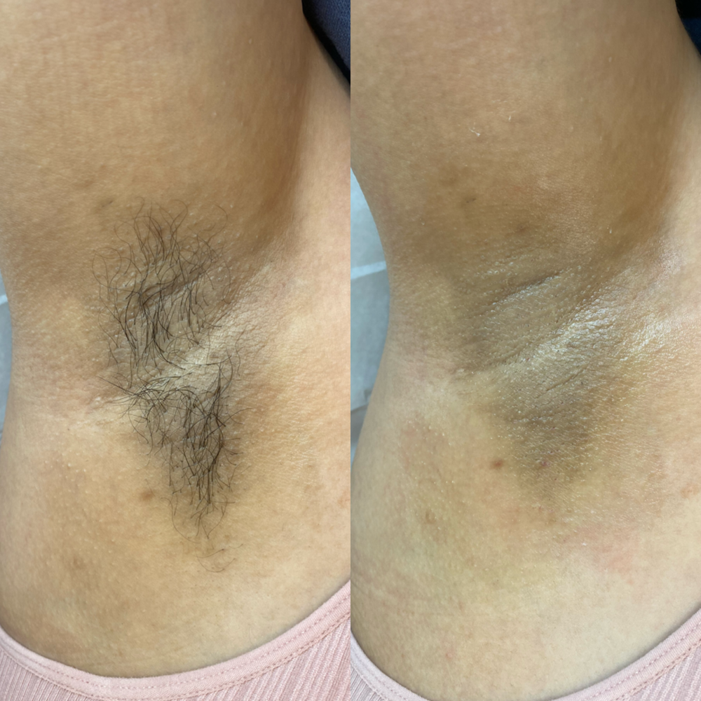 Underarm Wax