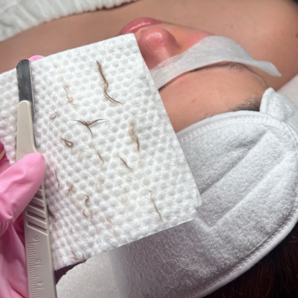 Dermaplaning at Adri_beautyskincare in Miami Lakes, FL