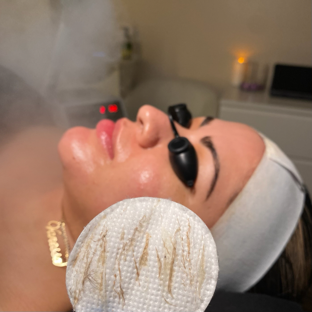 Ultimate Dermaplane & Enzyme Luxxe Facial