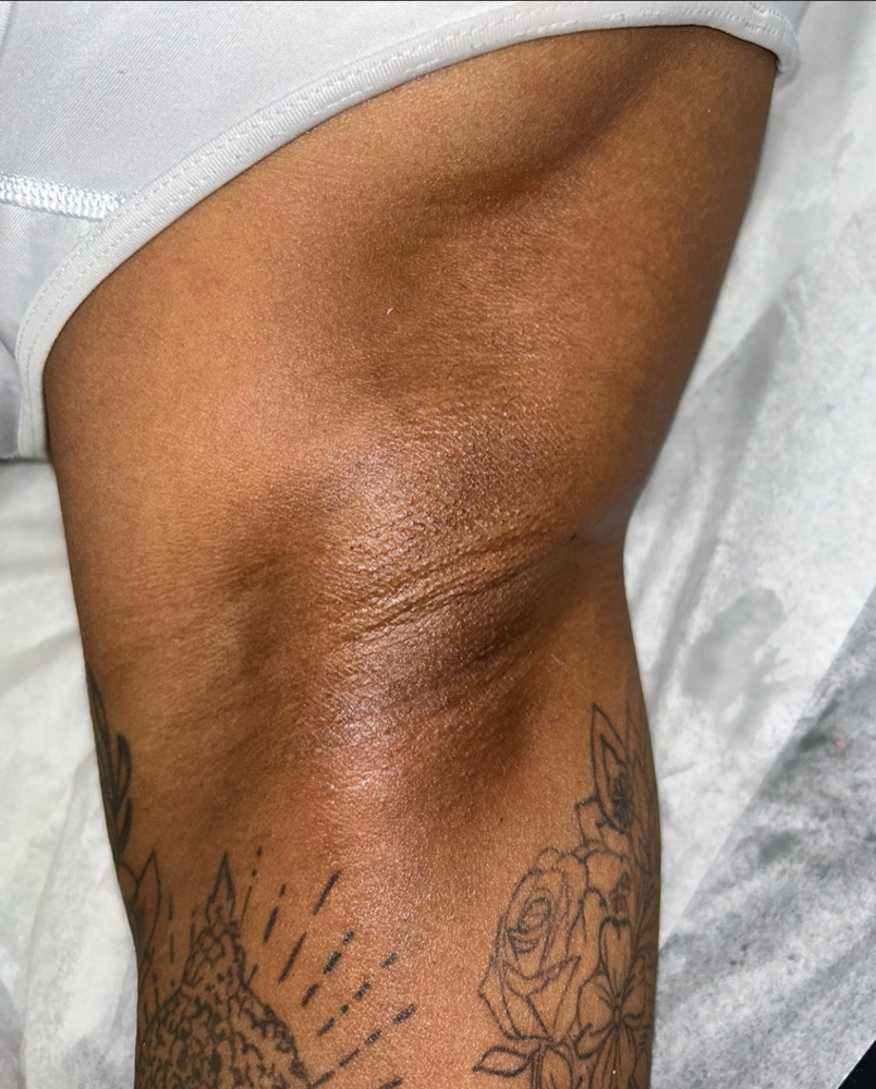 Underarm