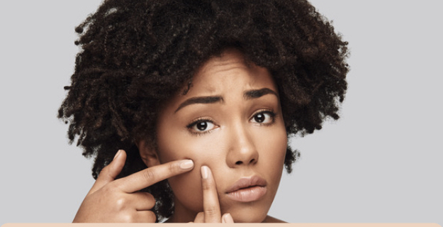 Teen Acne Facial