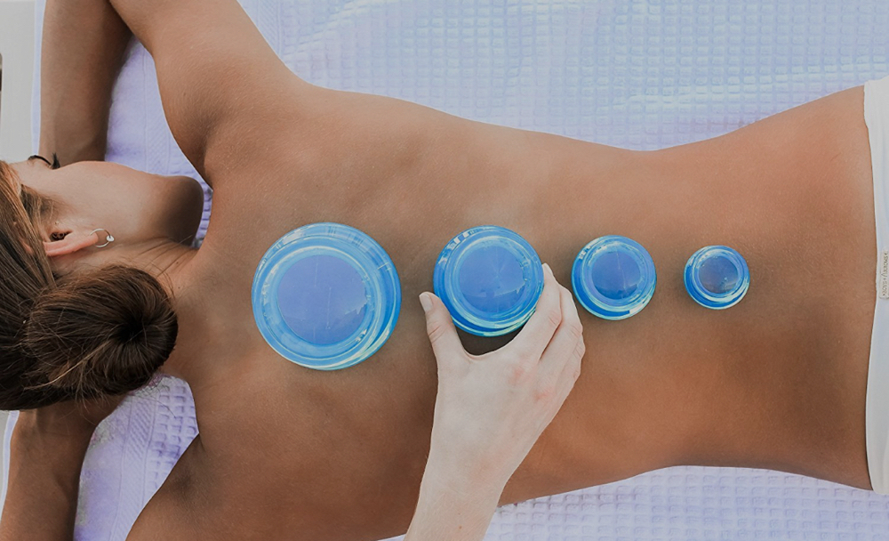 Cupping