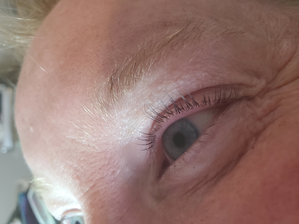 Lash Extension Removal