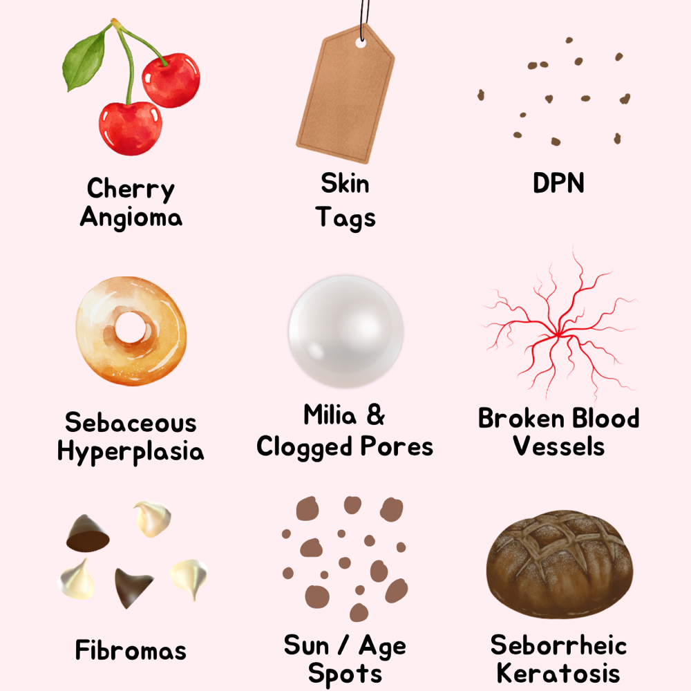 Skin Classic Consult & Prep (Essential for Hyperpigmentation-Prone Skin) at Skin Care by Kayla in Martinez, GA