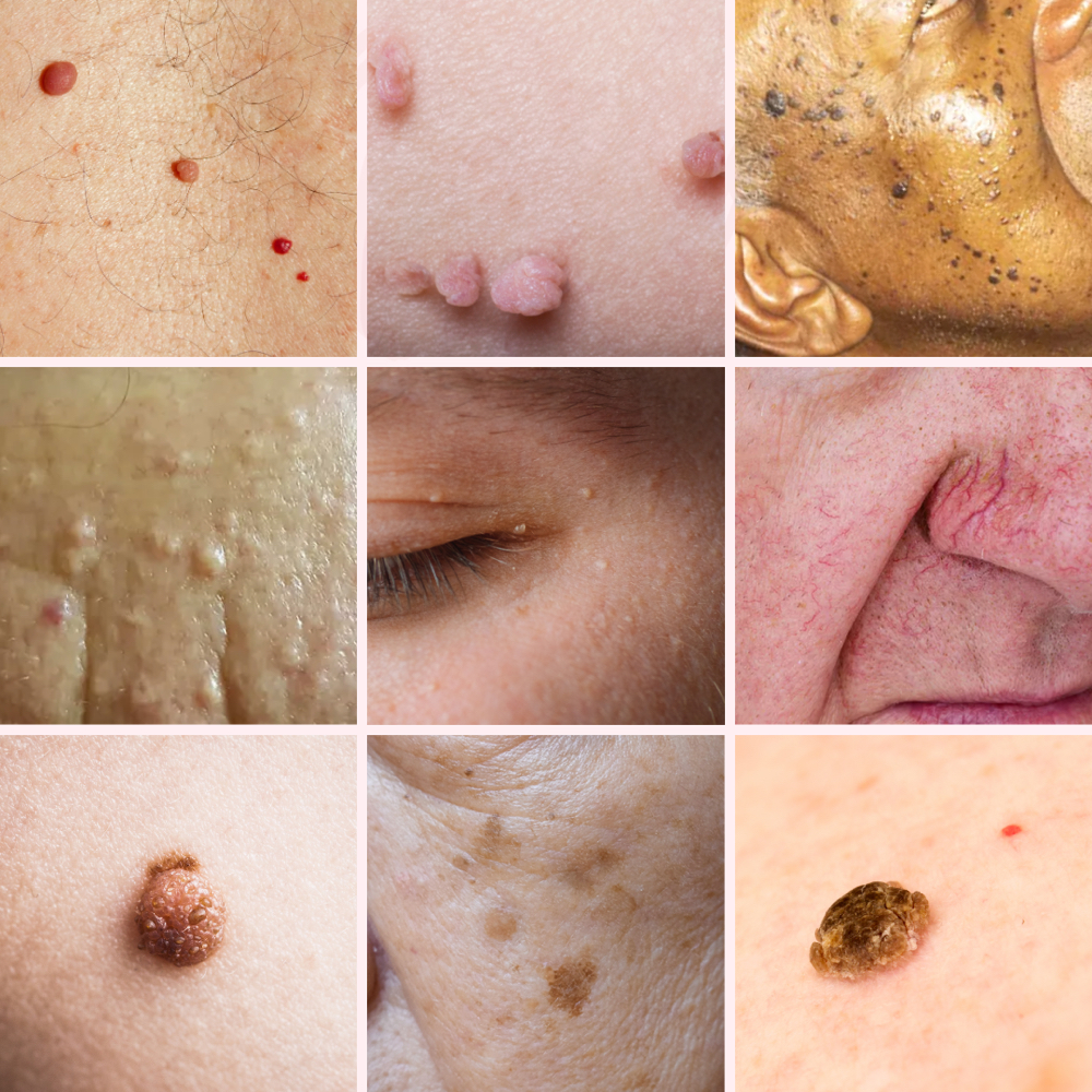 Skin Classic Consult at Skin Care by Kayla in Martinez, GA