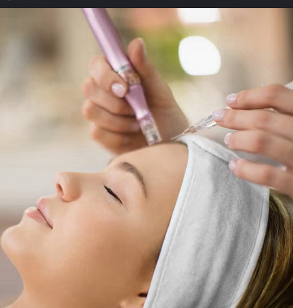 Microneedling