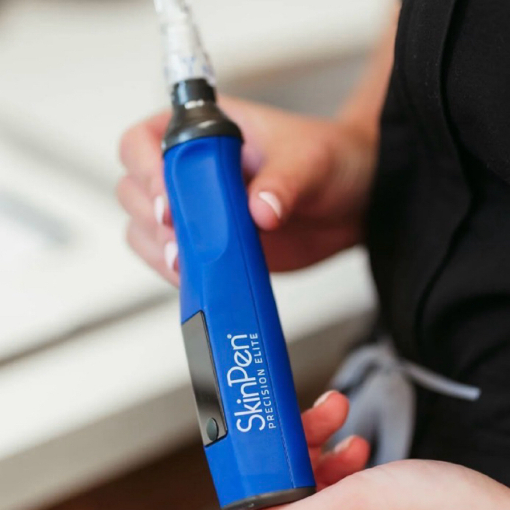 Microneedling at Symmetry Skin Studio in Centennial, CO