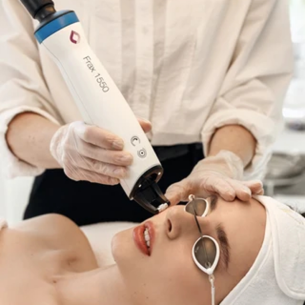 NORDLYS LASER FRAX / SKIN RESET 360 at GC BEAUTY CONCEPTS in Orlando, FL