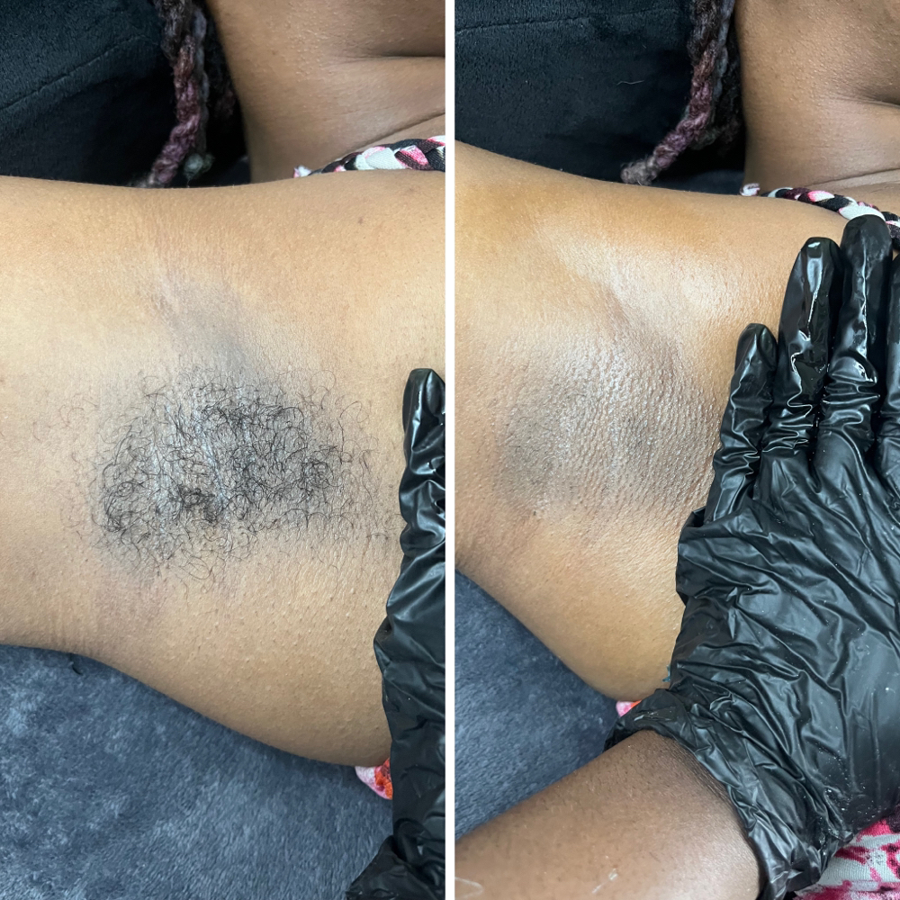 Under Arm Wax