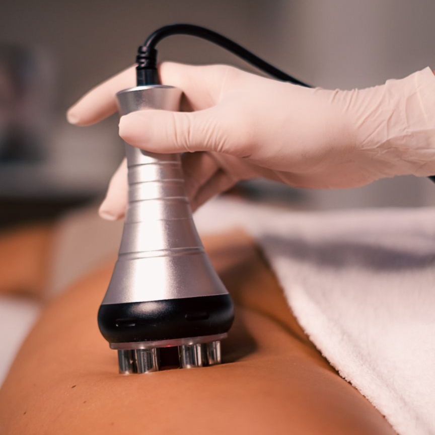 Body Radiofrequency at MediOne Wellness Center in Jacksonville, FL