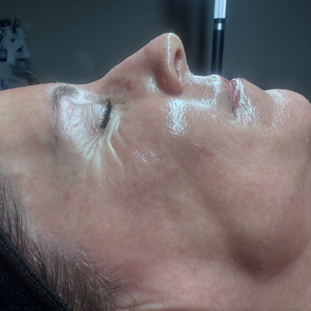 Glass Skin Facial