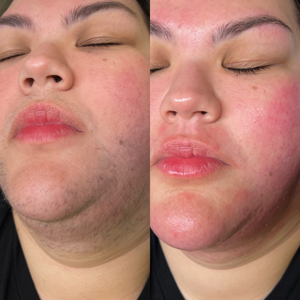 Face Wax
