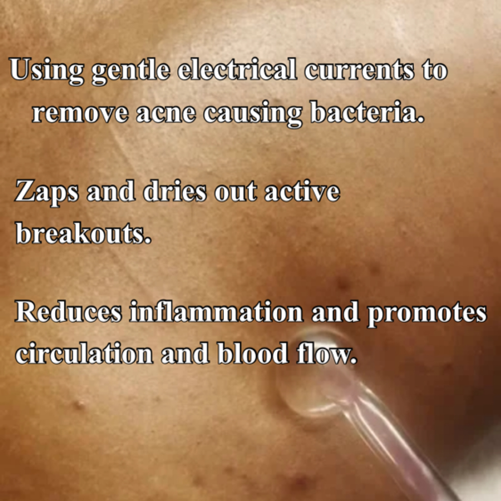 High Frequency Add-on at SkinGlowAddictllc in Greendale, WI